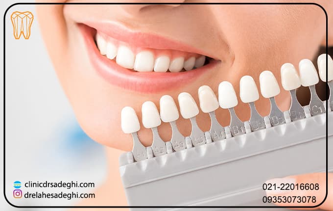 درمان های دندانپزشکی برای زردی دندان