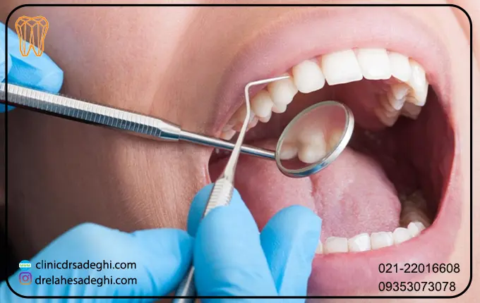 درمان های خانگی حساسیت دندان